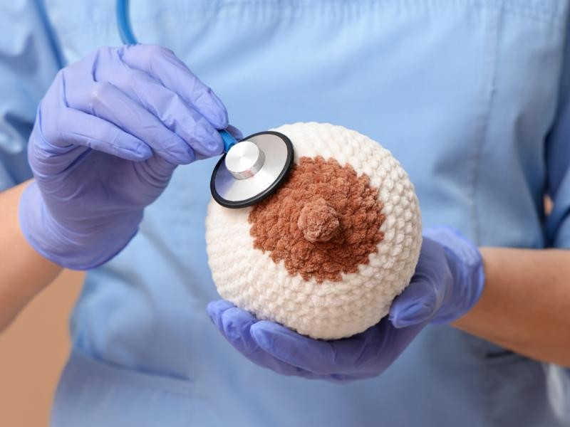 Senti um Carocinho no Seio, e Agora?