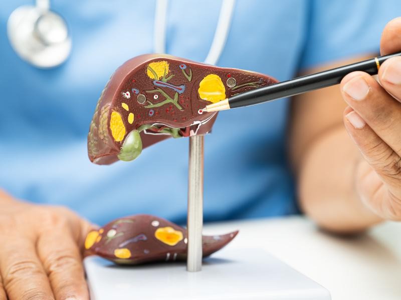 Doenças do Fígado: Sinais que Aparecem na Pele e nos Olhos