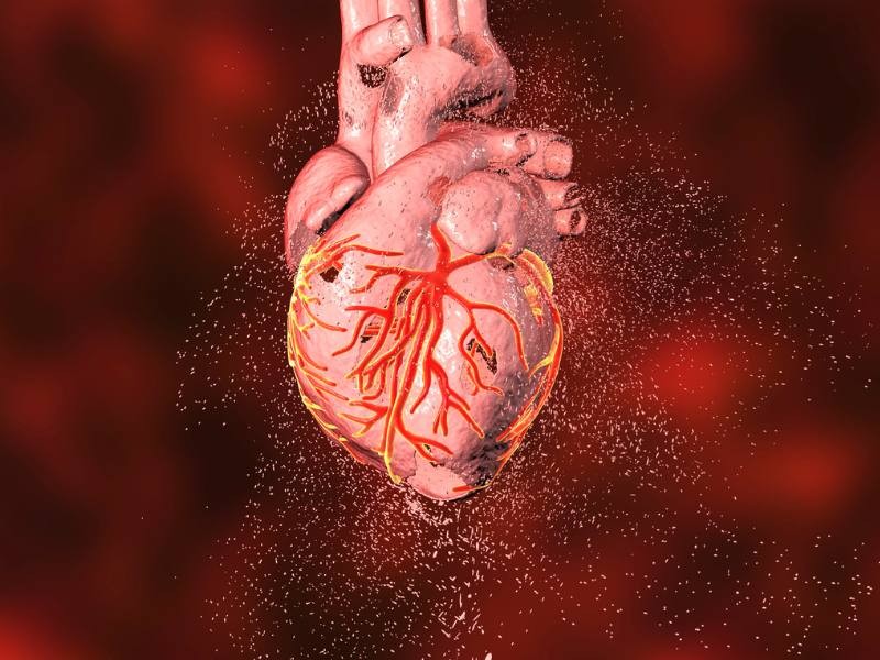 DOENÇA CARDIOVASCULAR: CONHEÇA TODOS OS TIPOS E CAUSAS DE DOENÇAS CARDIOVASCULARES