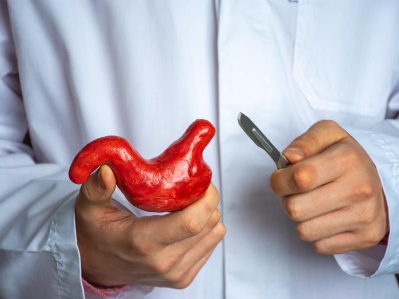 Cirurgia Bariátrica: Tipos, Indicações, Benefícios e Riscos