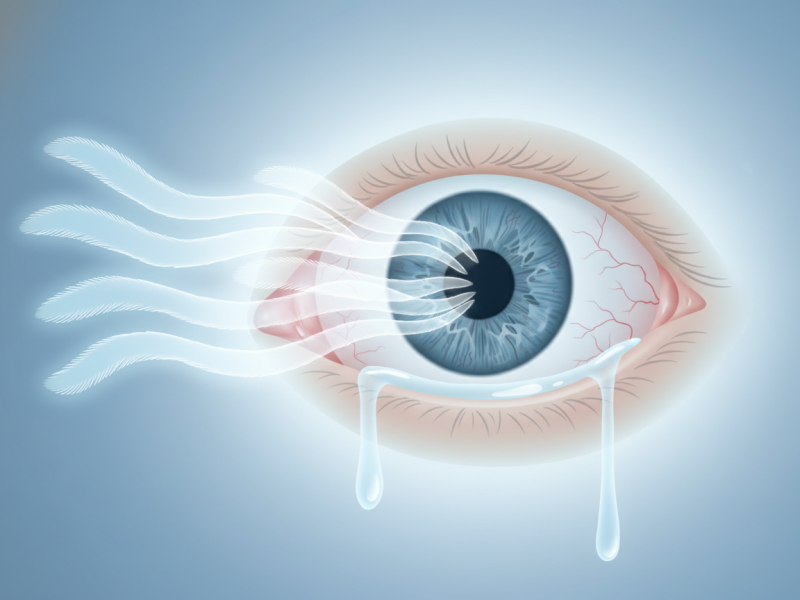 Sensibilidade à Luz Frequente: Quando Investigar Além da Enxaqueca