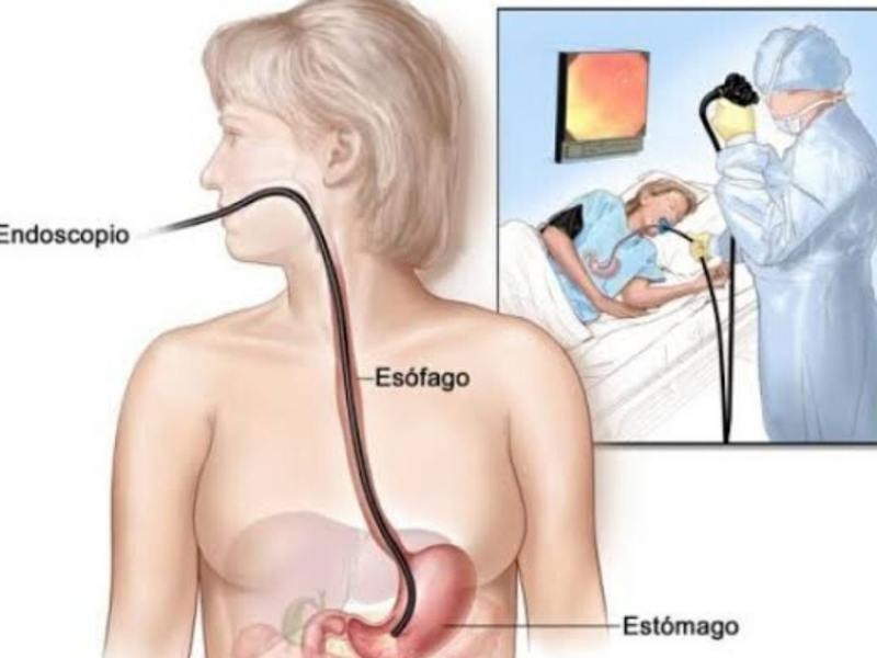 ENDOSCOPIA DIGESTIVA